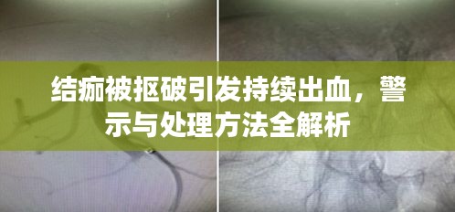 结痂被抠破引发持续出血，警示与处理方法全解析