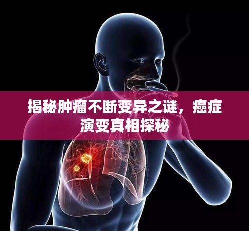 揭秘肿瘤不断变异之谜，癌症演变真相探秘